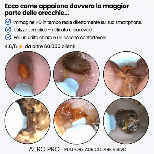 Aera Pro™
